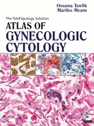 Atlas of Gynecologic Cytology