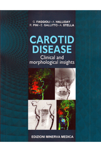 Carotid Disease