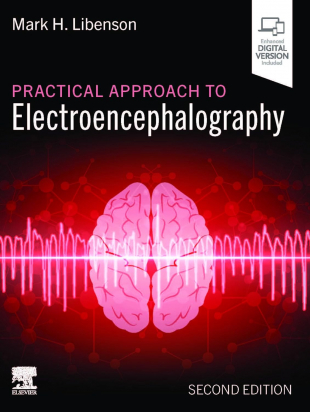 Practical Approach to Electroencephalography, 2nd Edition