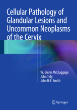 Cellular Pathology of Glandular Lesions and Uncommon Neoplasms of the Cervix