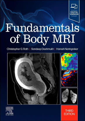 Fundamentals of Body MRI, 3rd Edition