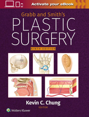 Grabb and Smith's Plastic Surgery: Print + eBook with Multimedia Ninth edition