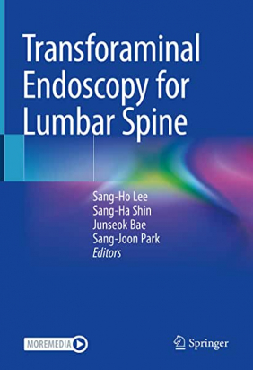 Transforaminal Endoscopy for Lumbar Spine