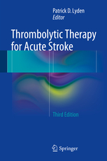 Thrombolytic Therapy for Acute Stroke