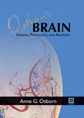 Osborn's Brain: Imaging, Pathology, and Anatomy