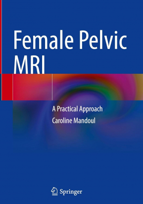 Female Pelvic MRI