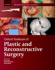 Oxford Textbook of Plastic and Reconstructive Surgery