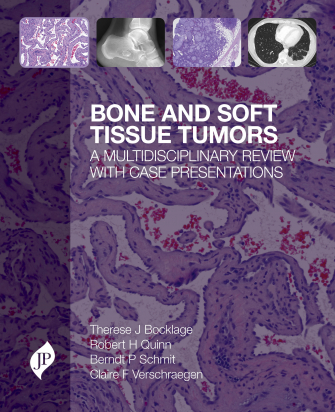 Bone and Soft Tissue Tumors