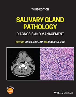 Salivary Gland Pathology: Diagnosis and Management, 3rd Edition