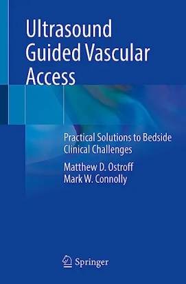 Ultrasound Guided Vascular Access