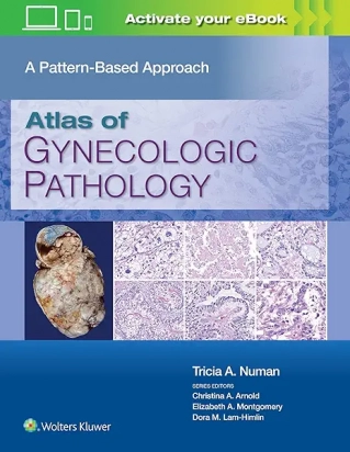 Atlas of Gynecologic Pathology A Pattern-Based Approach, First edition