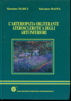 L'arteriopatia obliterante aterosclerotica degli arti inferiori