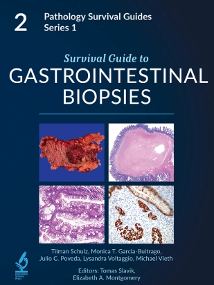 Gastrointestinal Biopsies  (Pathology Survival Guides Series 1 vol. 2