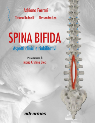 Spina Bifida