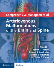 Comprehensive Management of Arteriovenous Malformations of the Brain and Spine