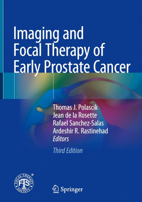 Imaging and Focal Therapy of Early Prostate Cancer