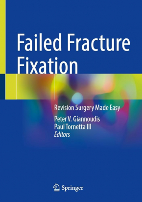 Failed Fracture Fixation