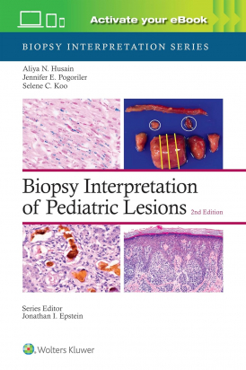 Biopsy Interpretation of Pediatric Lesions: Print + eBook with Multimedia Second edition