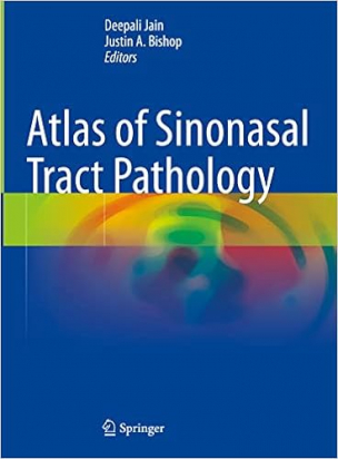 Atlas of Sinonasal Tract Pathology