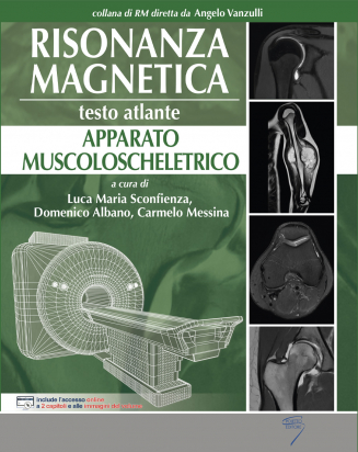 Risonanza Magnetica  - Apparato Muscoloscheletrico