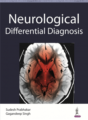 Neurological Differential Diagnosis