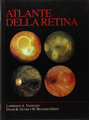 Atlante della retina