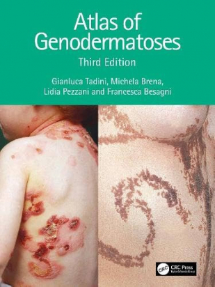 Atlas of Genodermatoses 3rd edition - copertina molle