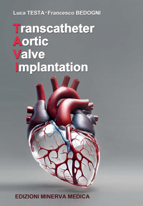 Transcatheter Aortic Valve Implantation - Edizioni Minerva Medica