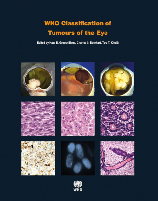 WHO Classification of the Eye. Fourth edition