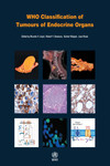 WHO Classification of Tumours of Endocrine Organs, Fourth Edition