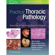 Practical Thoracic Pathology 