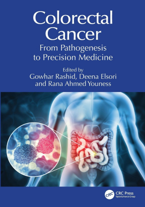 Colorectal Cancer