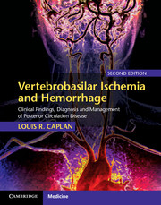 Vertebrobasilar Ischemia and Hemorrhage