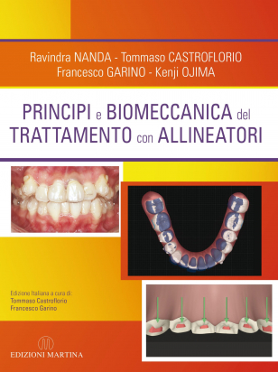 Principi e Biomeccanica del Trattamento con Allineatori