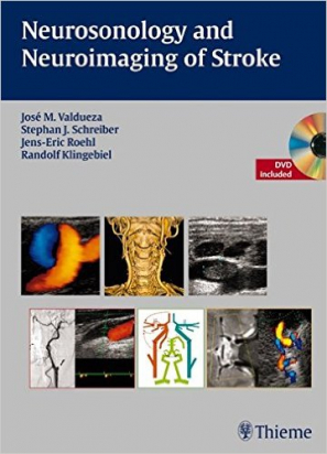 Neurosonology and Neuroimaging of Stroke