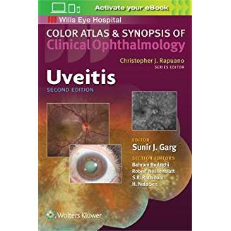 Uveitis 2nd edition