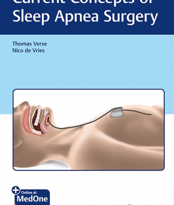 Current Concepts of Sleep Apnea Surgery