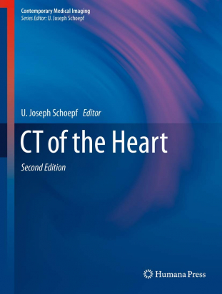 CT of the Heart  - Second Edition