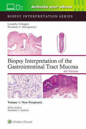 Biopsy Interpretation of the Gastrointestinal Tract Mucosa Volume 1 - 4th edition