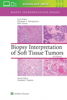 Biopsy Interpretation of Soft Tissue Tumors, Third edition