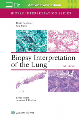 Biopsy Interpretation of the Lung, Third edition