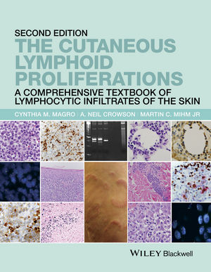 The Cutaneous Lymphoid Proliferations