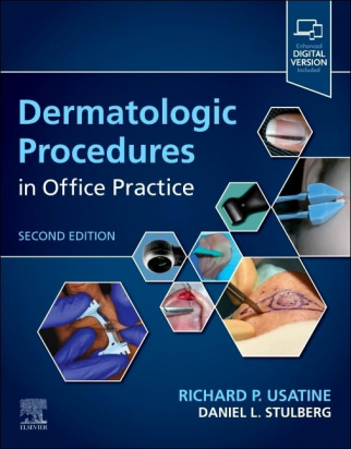 Dermatologic Procedures in Office Practice, 2nd Edition