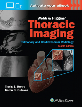 Webb & Higgins Thoracic Imaging, Fourth edition