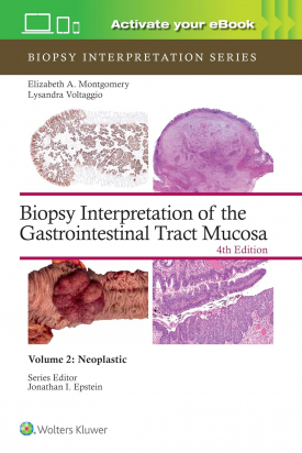 Biopsy Interpretation of the Gastrointestinal Tract Mucosa -Volume 2 Neoplastic: Print + eBook with Multimedia, Fourth edition