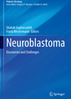 Neuroblastoma