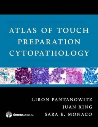 Atlas of Touch Preparation Cytopathology