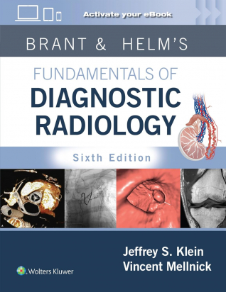 Brant & Helms' Fundamentals of Diagnostic Radiology: Print + eBook with Multimedia - Sixth edition