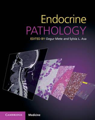 Endocrine Pathology