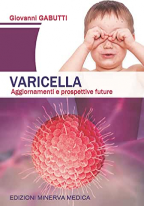 Varicella